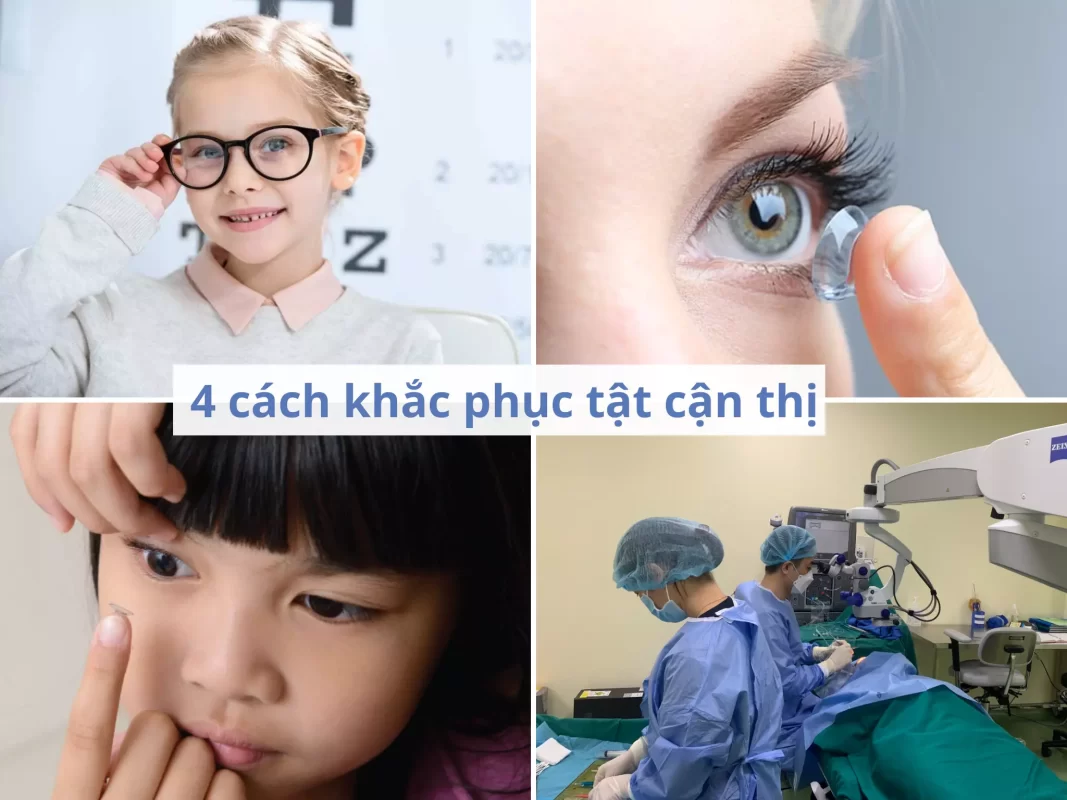 cách khắc phục tật cận thị