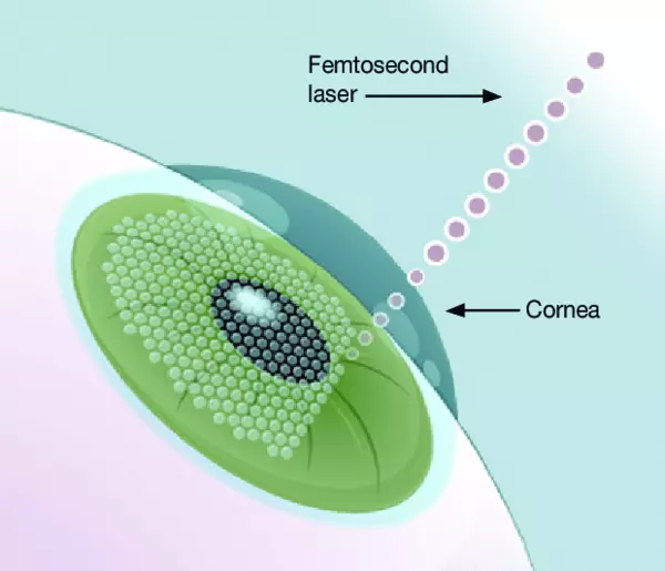 tia femtosecond laser