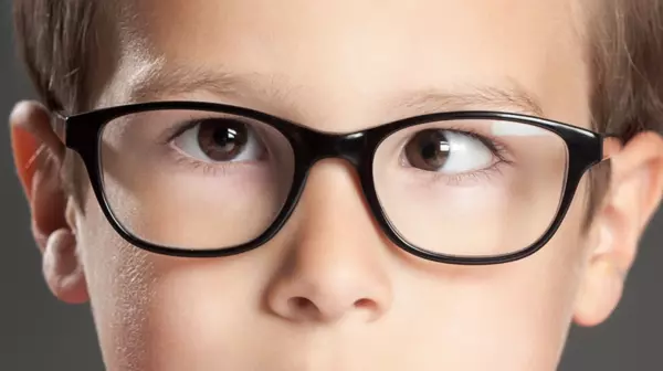 cách chữa mắt lác ở trẻ em
