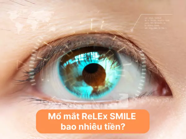 mổ mắt relex smile bao nhiêu tiền