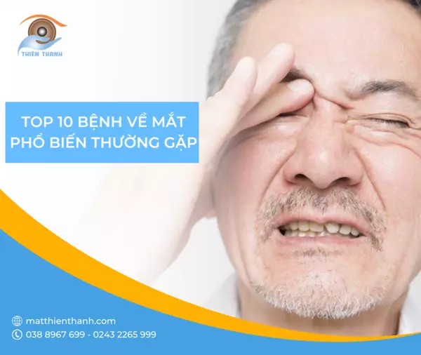 Top 10 bệnh về mắt phổ biến thường gặp