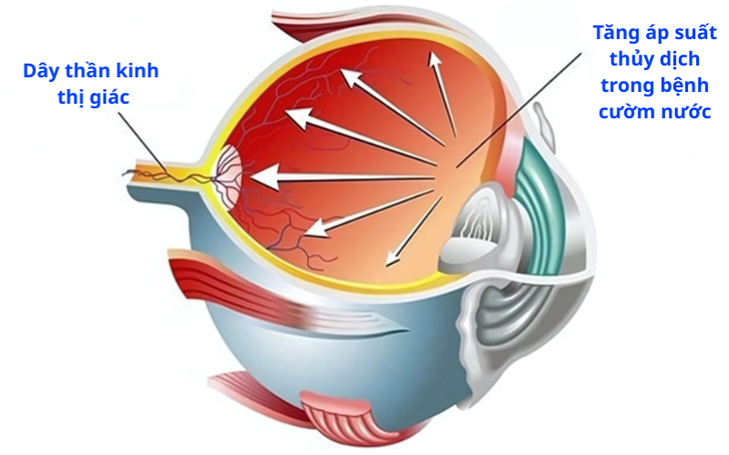 tổng quan về cườm nước