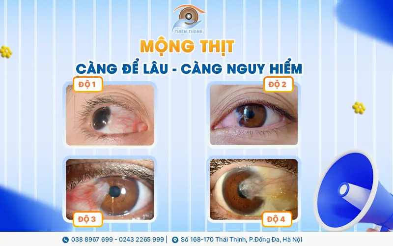MỘNG THỊT – CÀNG ĐỂ LÂU, CÀNG NGUY HIỂM
