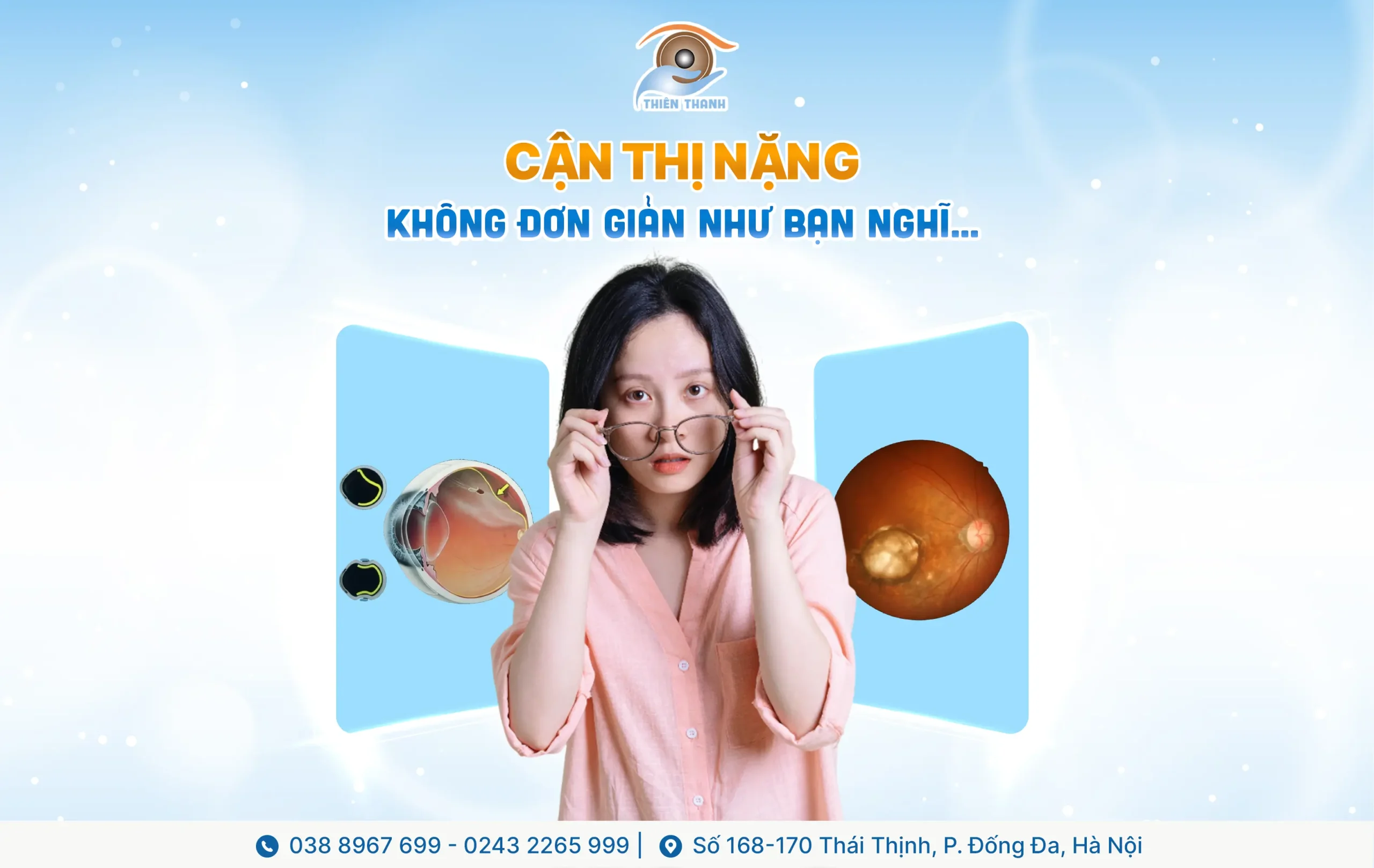 CẬN THỊ NẶNG KHÔNG ĐƠN GIẢN NHƯ BẠN NGHĨ