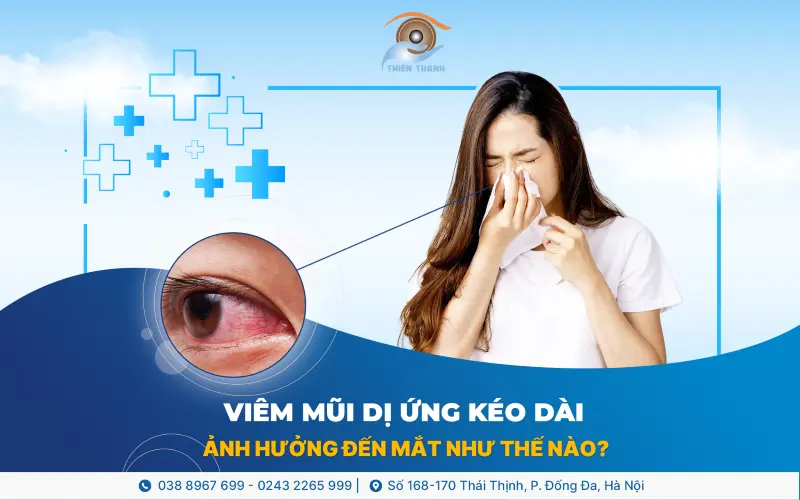 Viêm mũi dị ứng kéo dài – Đừng để đôi mắt “chịu trận” thay cho chiếc mũi