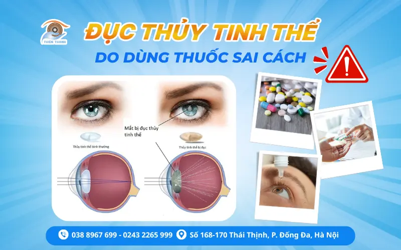 Đục thủy tinh thể không chỉ đến vì tuổi già