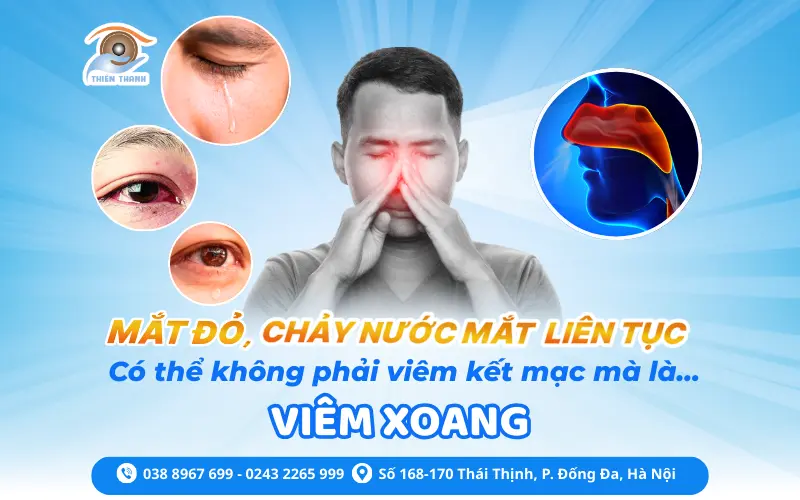 MẮT ĐỎ, CHẢY NƯỚC MẮT LIÊN TỤC – ĐỪNG CHỦ QUAN