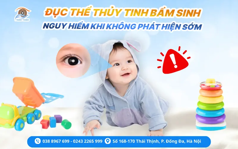 ĐỤC THỦY TINH THỂ BẨM SINH – NGUY HIỂM KHI KHÔNG PHÁT HIỆN SỚM 
