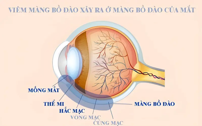 viêm màng bồ đào là gì