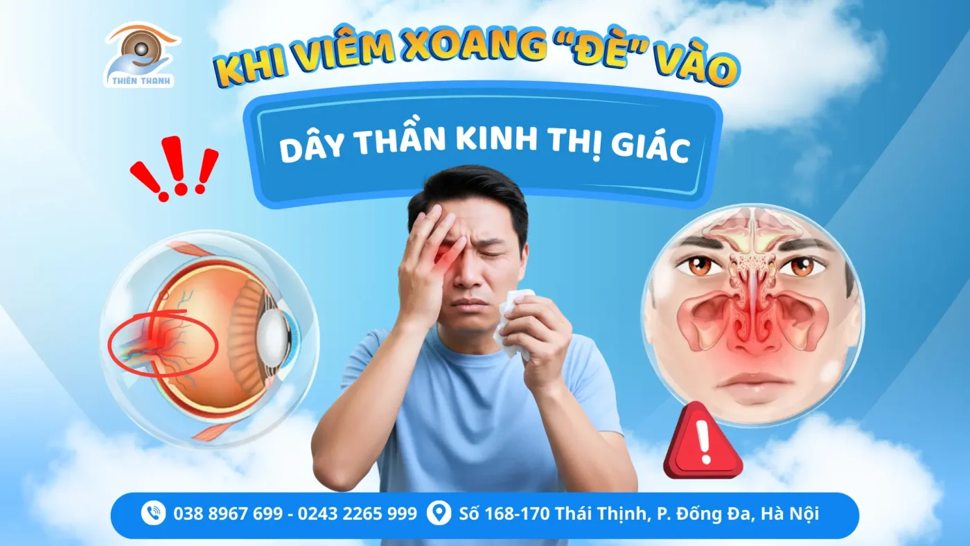 khi viêm xoang đè vào dây thần kinh thị giác
