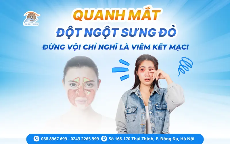 quanh mắt đột ngột sưng đỏ
