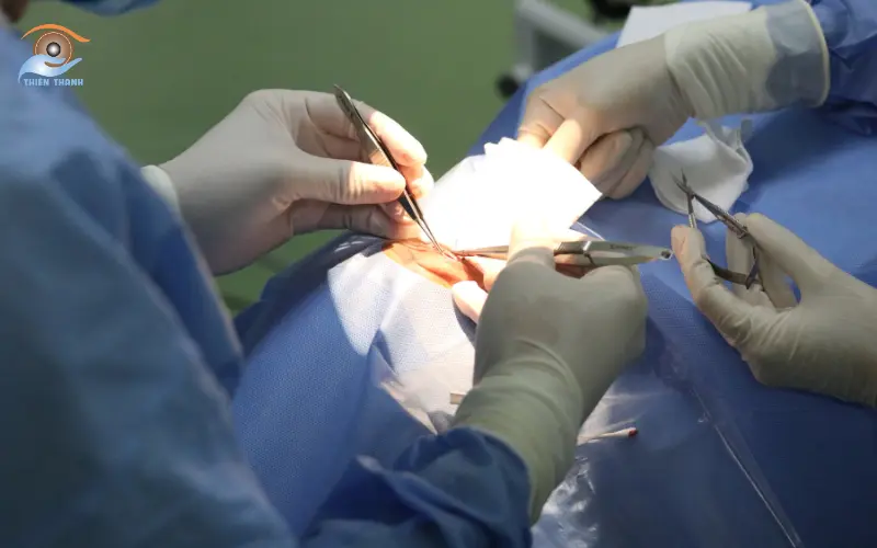 phẫu thuật sa da mi