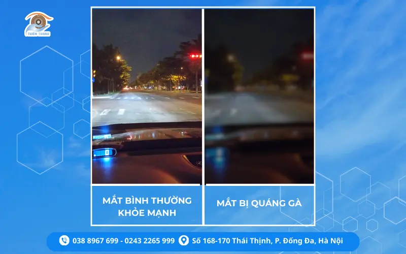 QUÁNG GÀ LÀ GÌ?