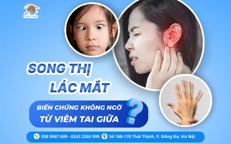 LÁC MẮT – NHÌN ĐÔI: ĐỪNG CHỈ NGHĨ LÀ BỆNH CỦA MẮT!
