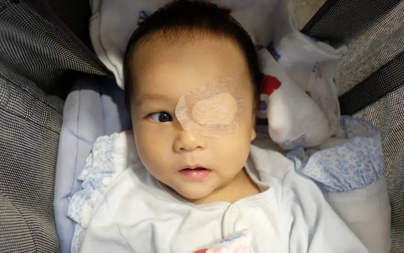 trẻ bị lác khi mới chào đời