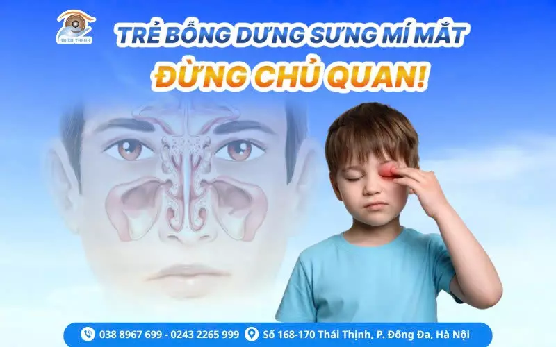 TRẺ BỖNG DƯNG SƯNG MÍ MẮT – ĐỪNG CHỦ QUAN!