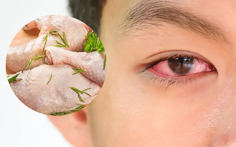 Viêm kết mạc có ăn được thịt gà không? Lời khuyên từ chuyên gia mắt