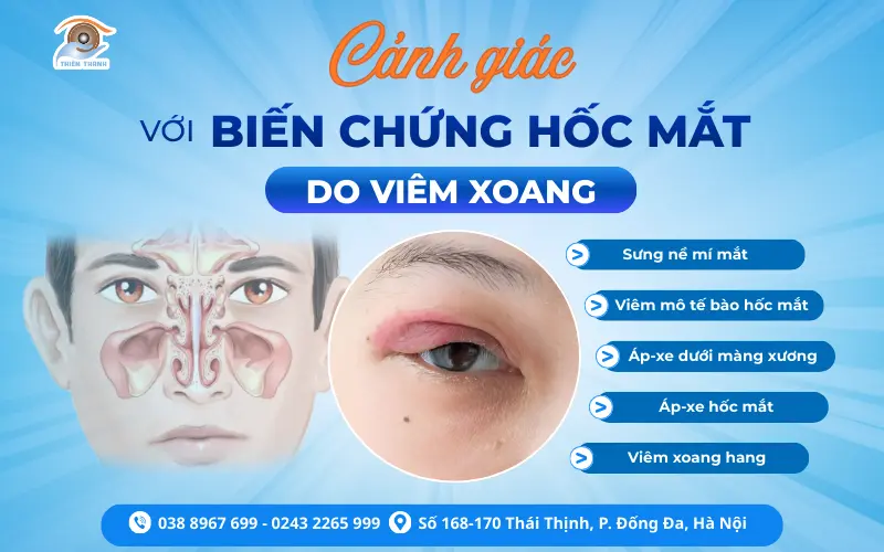 VIÊM XOANG – ĐỪNG ĐỂ MẤT MẮT MỚI GIẬT MÌNH!