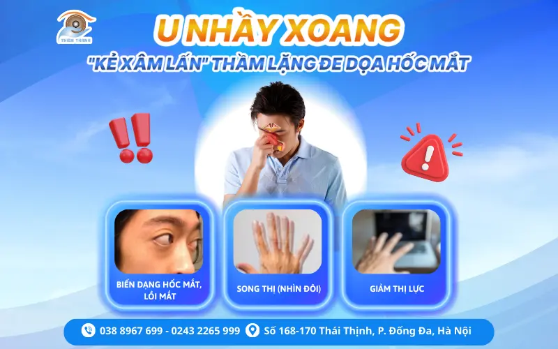 U NHẦY XOANG – “KẺ XÂM LẤN” THẦM LẶNG ĐE DỌA THỊ LỰC