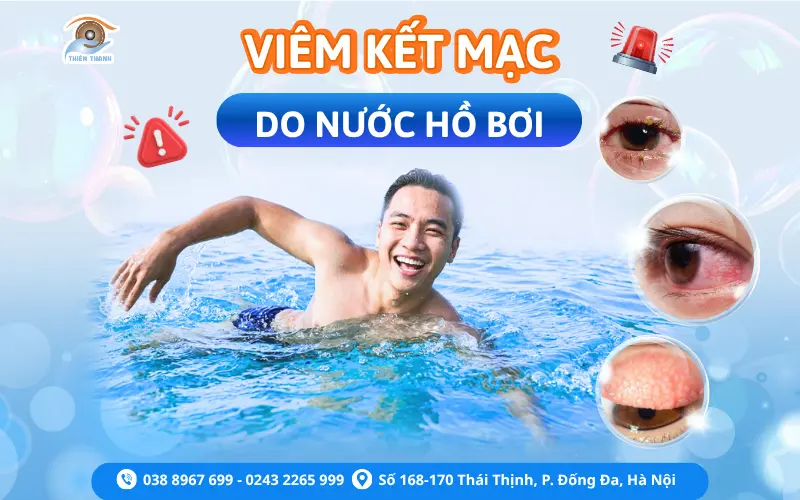 viêm kết mạc do nước hồ bơi