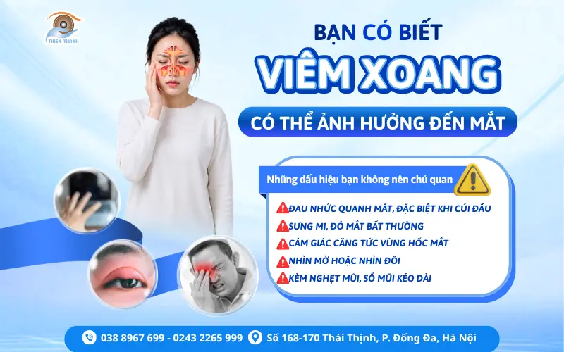 BẠN CÓ BIẾT VIÊM XOANG CÓ THỂ ẢNH HƯỞNG ĐẾN MẮT